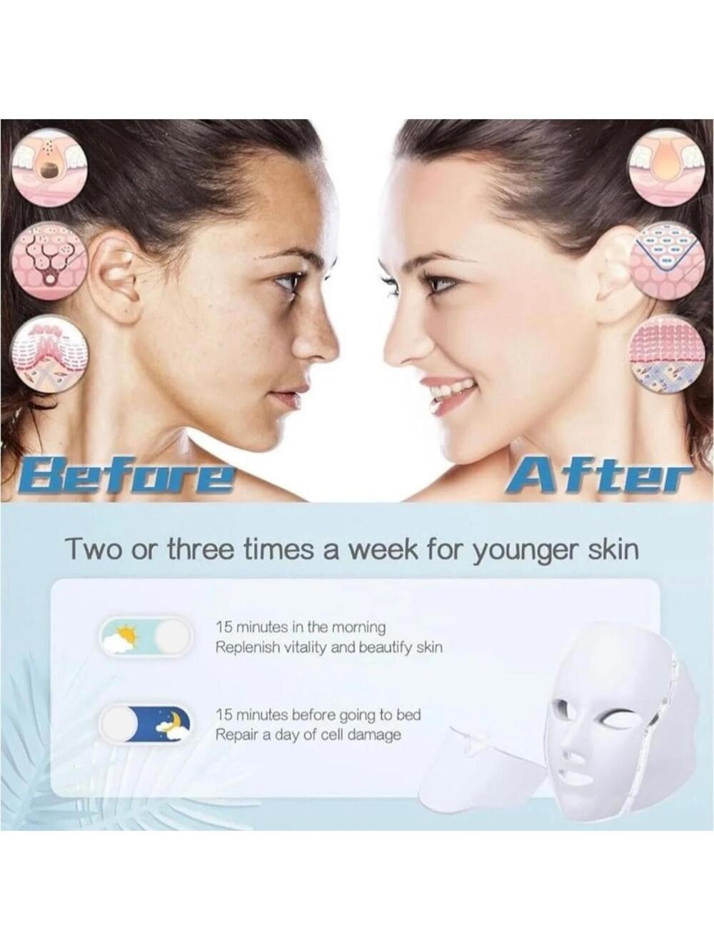 HXDZFX LED Facial Light Therapy Mask - White - Picture 5 of 5